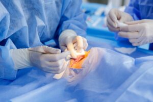 Chirurgie reconstructrice du regard : les techniques chirurgicales utilisées